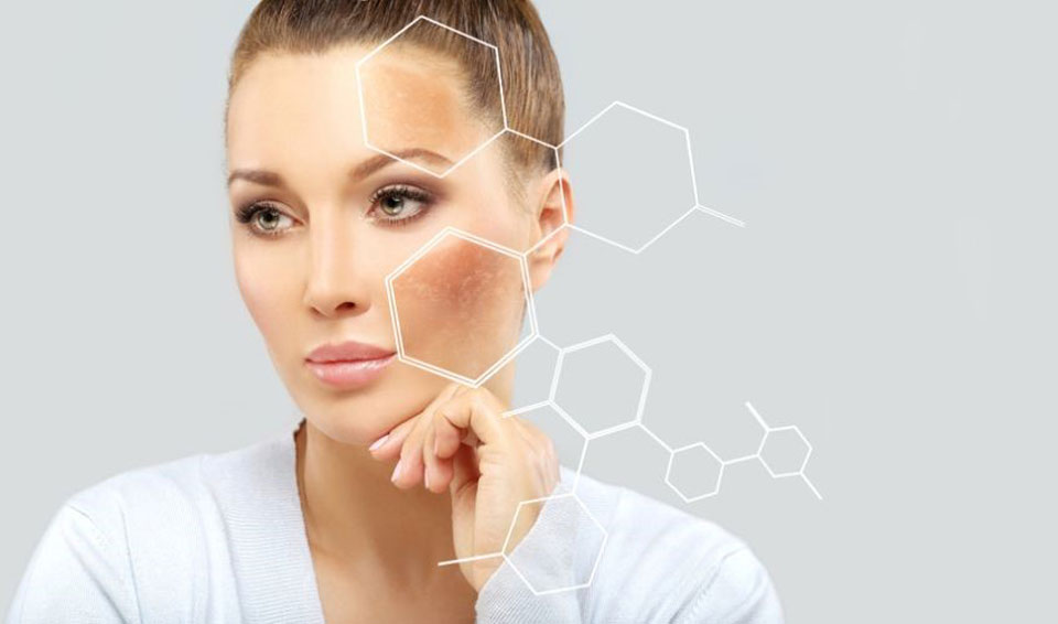 Hydroquinone works on removing dark spots