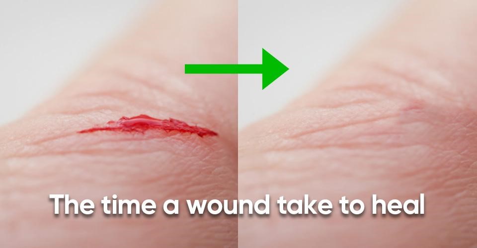 The time a wound take to heal