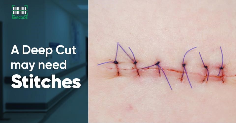 A deep cut may need stitches