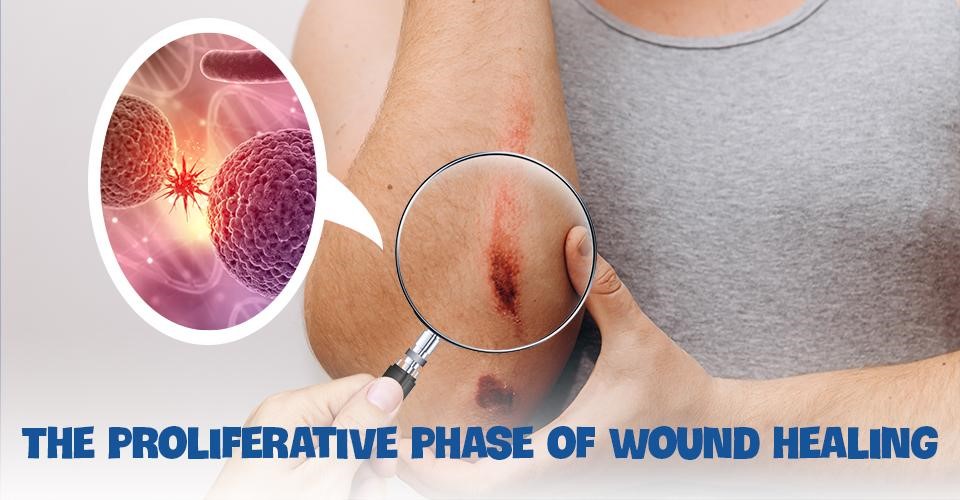 The proliferative phase of wound healing
