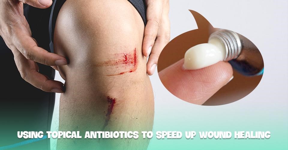 Using topical antibiotics to speed up wound healing