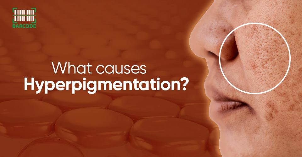What Causes Hyperpigmentation? [According to Experts]