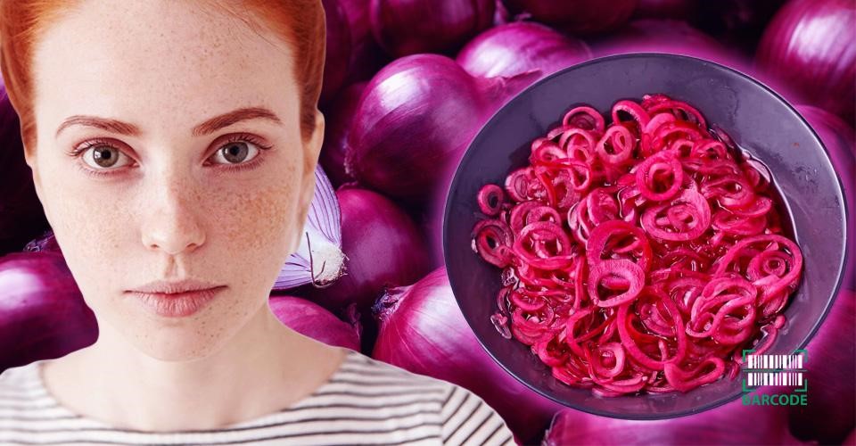 Using red onions is a great way to treat hyperpigmentation